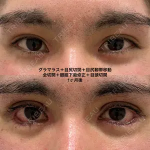 エターナル美容クリニック 久門田 詳医師の症例