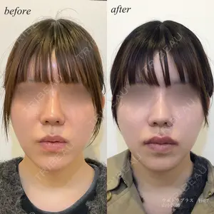 DMTC美容皮膚科 日本橋院 山中大介医師の症例