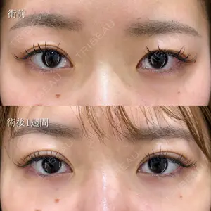 HAAB×DREAM BEAUTY CLINIC 東京本院 萩原 昂医師の症例