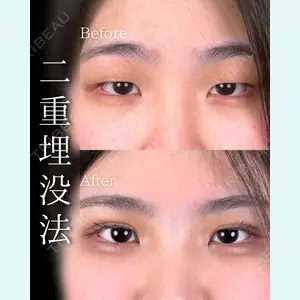 症例