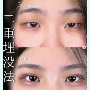 症例