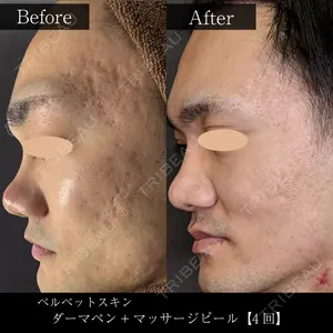 麹町皮ふ科・形成外科クリニック 安藤 玲奈医師の症例