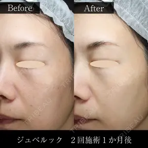 麹町皮ふ科・形成外科クリニック 安藤 玲奈医師の症例