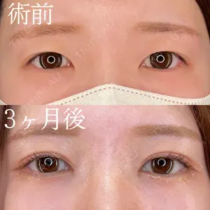 HAAB×DREAM BEAUTY CLINIC 大阪梅田院 柏木 太雅医師の症例