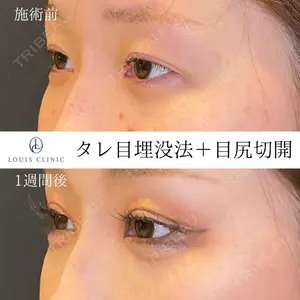 LOUIS CLINIC 二子玉川院【ルイクリニック】 小松 塁医師の症例