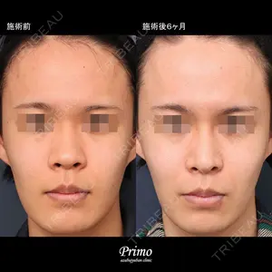 プリモ麻布十番クリニック 大場教弘医師の症例