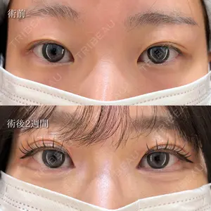 症例