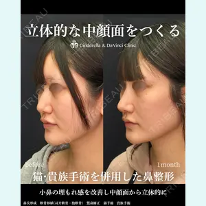 シンデレラ＆ダヴィンチクリニック 宮田 洋佑医師の症例
