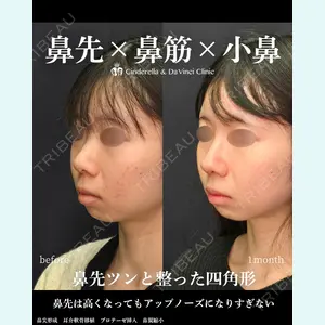 シンデレラ＆ダヴィンチクリニック 宮田 洋佑医師の症例