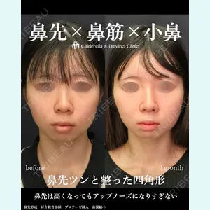 シンデレラ＆ダヴィンチクリニック 宮田 洋佑医師の症例