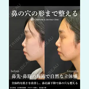 シンデレラ＆ダヴィンチクリニック 宮田 洋佑医師の症例