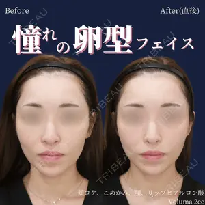 症例