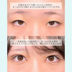 東京シンデレラ美容外科 大宮院 竹田 昌平医師の症例