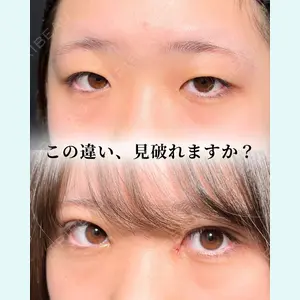 東京シンデレラ美容外科 大宮院 竹田 昌平医師の症例