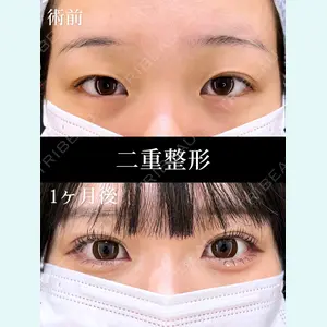 HAAB×DREAM BEAUTY CLINIC 東京本院 田中 優太医師の症例