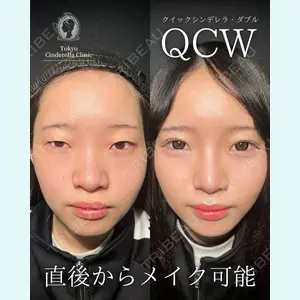 東京シンデレラ美容外科 大宮院 竹田 昌平医師の症例