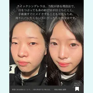 東京シンデレラ美容外科 大宮院 竹田 昌平医師の症例