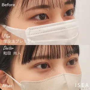 症例