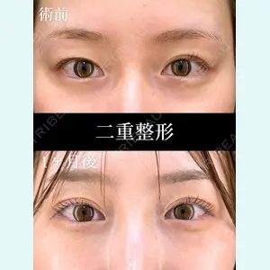 HAAB×DREAM BEAUTY CLINIC 東京本院 田中 優太医師の症例