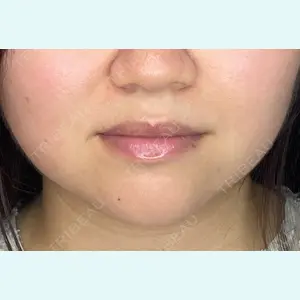 はやし歯科ほんまち院の症例