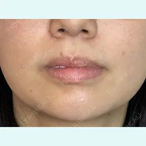 はやし歯科ほんまち院の症例