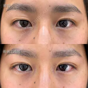 HAAB×DREAM BEAUTY CLINIC 東京本院 萩原 昂医師の症例