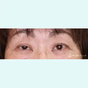 聖心美容クリニック 横浜院 佐々木 直美医師の症例