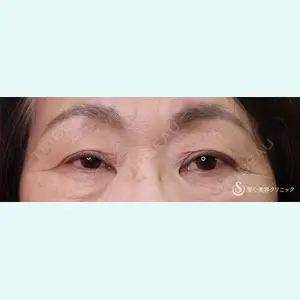 聖心美容クリニック 横浜院 佐々木 直美医師の症例
