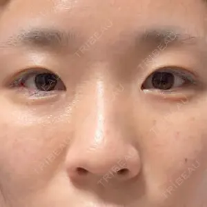 症例