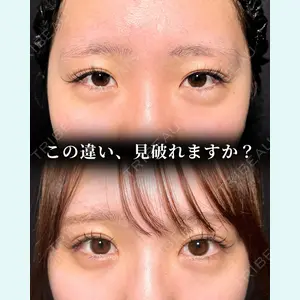東京シンデレラ美容外科 大宮院 竹田 昌平医師の症例
