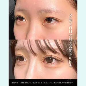 東京シンデレラ美容外科 大宮院 竹田 昌平医師の症例