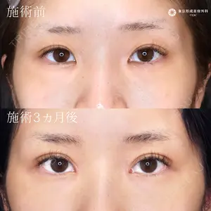東京形成美容外科 船橋院 弓削田　浩主医師の症例