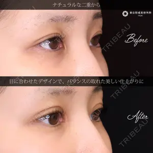 東京形成美容外科 船橋院 弓削田　浩主医師の症例