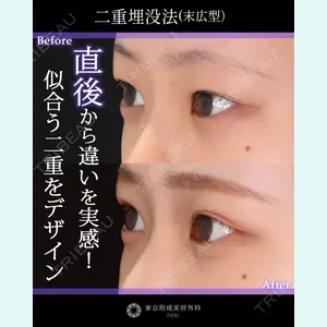 東京形成美容外科 銀座院 中尾 真紀医師の症例