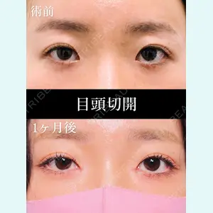 HAAB×DREAM BEAUTY CLINIC 大阪梅田院 鈴木 馨斗医師の症例