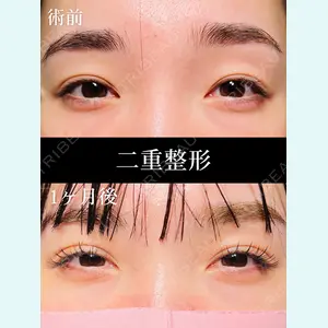 HAAB×DREAM BEAUTY CLINIC 大阪梅田院 鈴木 馨斗医師の症例