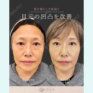 ルラ美容クリニック 名古屋栄院 関戸 優医師の症例