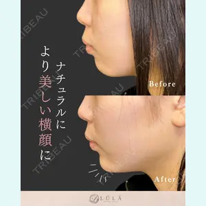 ルラ美容クリニック 名古屋栄院 関戸 優医師の症例