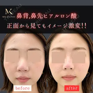症例