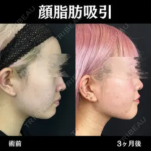 ルラ美容クリニック 新宿院 陶 美梨医師の症例
