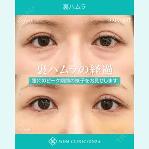症例