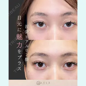 ルラ美容クリニック 名古屋栄院 関戸 優医師の症例