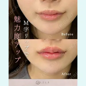 ルラ美容クリニック 名古屋栄院 関戸 優医師の症例