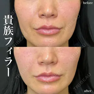 ルラ美容クリニック 名古屋栄院 関戸 優医師の症例