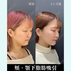 HAAB×DREAM BEAUTY CLINIC 東京本院 吉岡 修一医師の症例