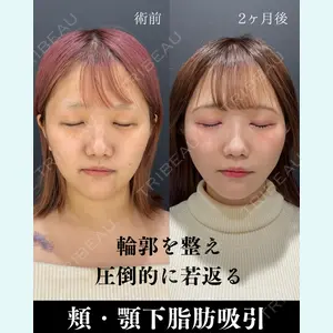 HAAB×DREAM BEAUTY CLINIC 東京本院 吉岡 修一医師の症例