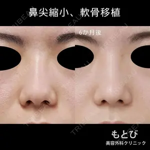 もとび美容外科クリニック 新宿院 西尾 謙三郎医師の症例