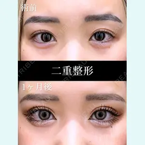 HAAB×DREAM BEAUTY CLINIC 東京本院 田中 優太医師の症例