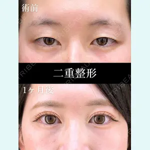 HAAB×DREAM BEAUTY CLINIC 東京本院 田中 優太医師の症例