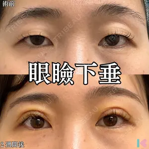 形成外科と美容外科のクリニック池袋 春日 航医師の症例